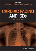 Cardiac Pacing and ICDs (ePub eBook)